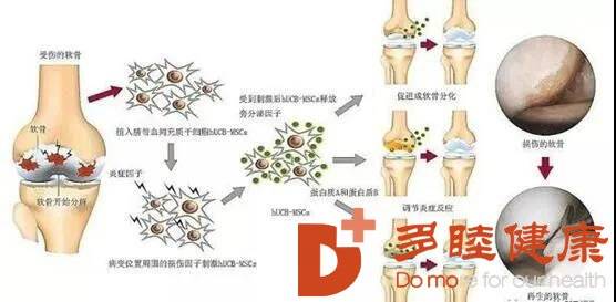 關(guān)節(jié)軟骨再生最新進(jìn)展與觀點論述揭秘